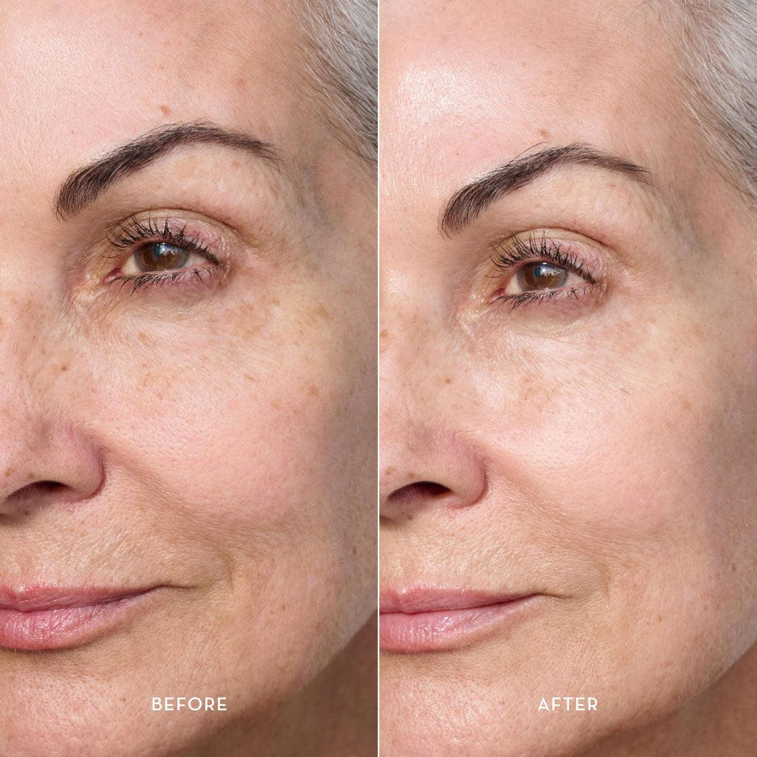 Lip plumper all'acido ialuronico TheDermaSkin per labbra morbide e contorno occhi levigato
